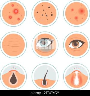 Face care. Skin problems, acne and inflammation. Cleaning infographics ...