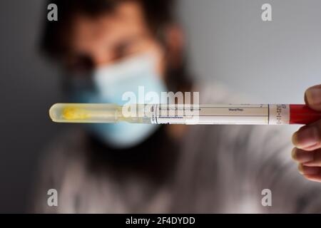 Nurse holding a tube. Rotavirus test. Man wearing a face mask grabbing a sample of feces to examined in a laboratory Stock Photo