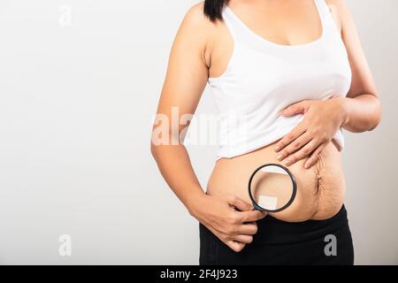 Close up of Asian mother woman use magnifying glass show stretch mark loose lower abdomen skin she fat after pregnancy baby birth isolated on white ba Stock Photo