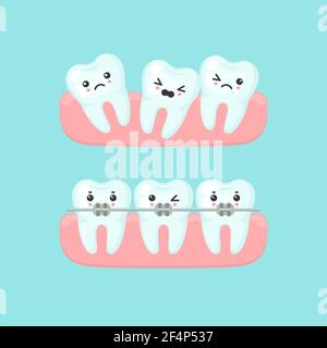 Braces alignment stomatology concept, cute colorful teeth vector illustration Stock Vector