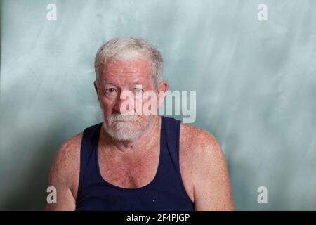 An old caucasian man dressed in a blue singlet, with a lot of sun damage and skin cancers and  a grumpy angry expression on his face. Stock Photo