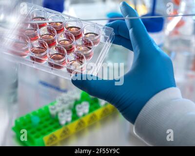 Technician holding multi well plate with blood samples in laboratory Stock Photo