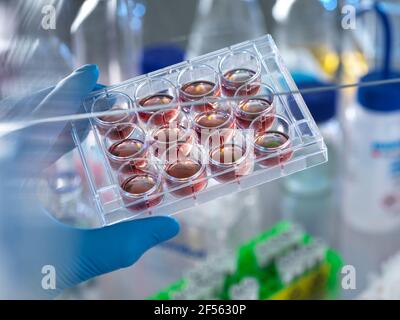 Scientist holding multi well plate with blood samples in laboratory Stock Photo
