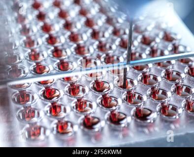 Blood samples in container at lab Stock Photo