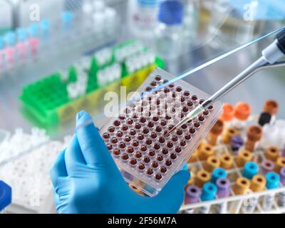 Scientist pipetting blood sample in microplate at laboratory Stock Photo