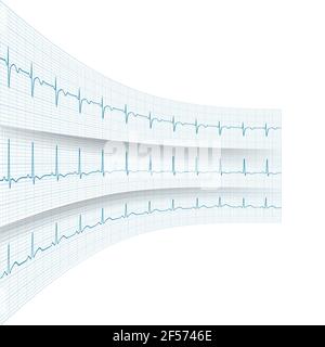 ECG charts in motion a as concept of a course of life, vector. Stock Vector