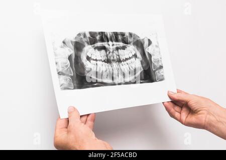 Doctor's hands are holding and examining an x-ray picture of teeth on a white background in medical office. Stock Photo
