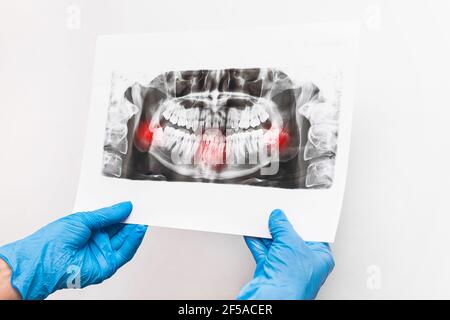 Doctor's hands in protective medical gloves are holding and examining an x-ray picture of teeth on a white background. Stock Photo