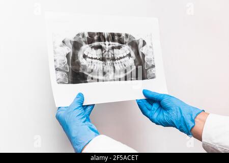 Doctor's hands in protective medical gloves are holding and examining an x-ray picture of teeth on a white background. Stock Photo