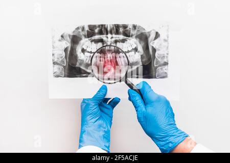 A doctor in protective medical gloves holds an X-ray picture of teeth in her hands and examines it through a magnifying glass on a white background. Stock Photo