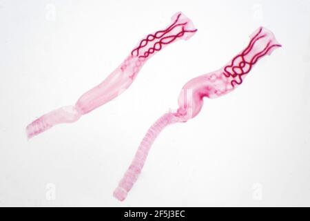 Tapeworm, light micrograph