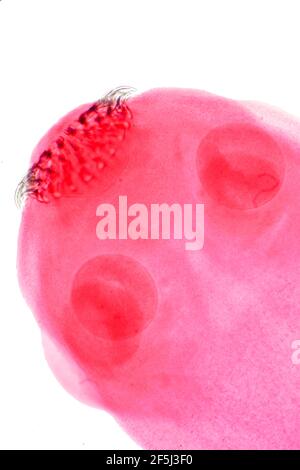 Tapeworm, light micrograph