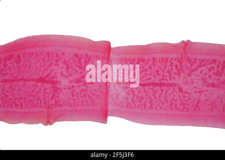 Tapeworm, light micrograph