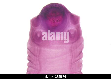 Tapeworm, light micrograph