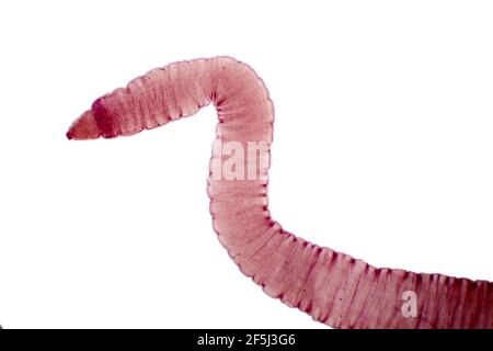 Tapeworm, light micrograph