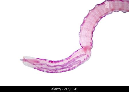 Tapeworm, light micrograph