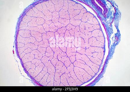 Human optic nerve, light micrograph Stock Photo
