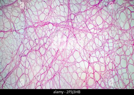 Areolar connective tissue, light micrograph Stock Photo