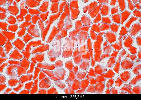 Skeletal muscle, light micrograph Stock Photo