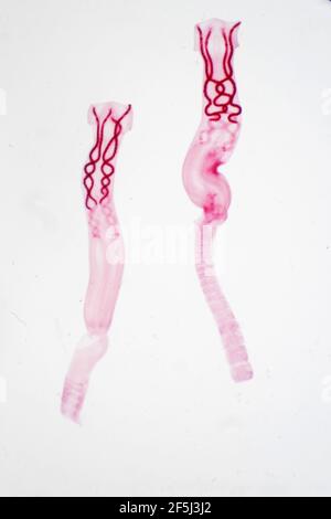 Tapeworm, light micrograph