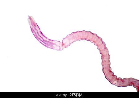 Tapeworm of cattle, light micrograph