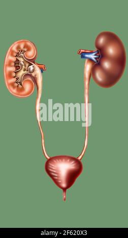 Kidney Stones Stock Photo