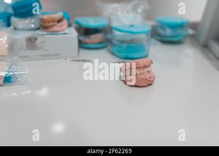 Dental casting gypsum model plaster cast stomatologic human jaws prosthetic laboratory, technical shots.dental health concept. Stock Photo