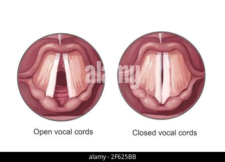 Open and Closed Vocal Chords, Illustration Stock Photo