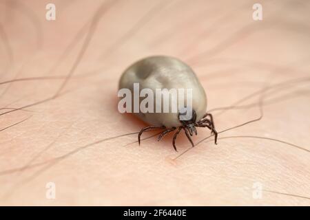 Castor bean tick, Ixodes ricinus, carrier of diseases like tbe and borreliosis filled with blood crawling on human skin Stock Photo