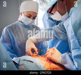 Doctors in medical masks doing abdominoplasty surgery. Stock Photo