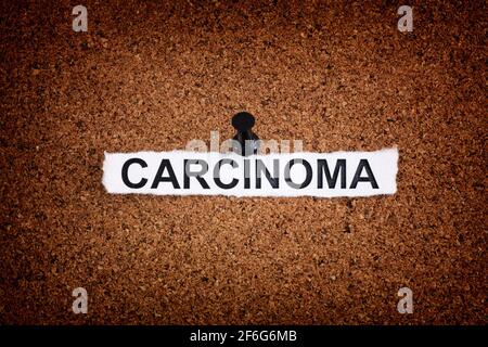 Carcinoma. Torn piece of paper with the word Carcinoma pinned on a cork board. Close up. Stock Photo