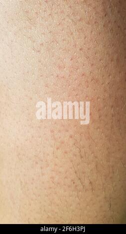 Human skin close up. Structure of Skin Stock Photo - Alamy