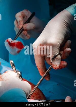 The bloody hands of surgeons in sterile gloves work with a medical instrument during a surgical operation. Stock Photo