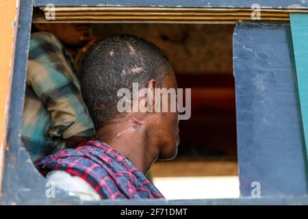 Ethiopian refugees migrated to Sudan and live in refugee camp Stock Photo