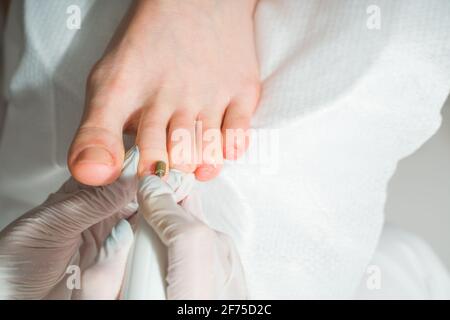 A Podiatrist doctor who takes care of a woman's toenails. Cosmetic procedures of the feet Stock Photo