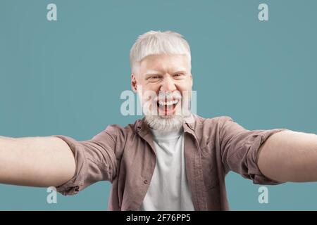Happy albino guy with unusual appearance taking selfie on turquoise studio background, smiling at camera and having fun Stock Photo