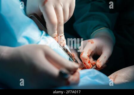 The bloody hands of surgeons in sterile gloves work with a medical instrument during a surgical operation. Stock Photo