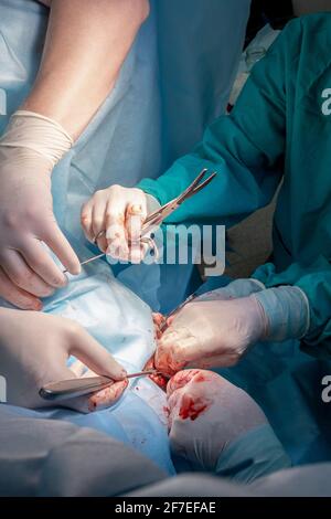 The bloody hands of surgeons in sterile gloves work with a medical instrument during a surgical operation. Stock Photo