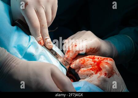 The bloody hands of surgeons in sterile gloves work with a medical instrument during a surgical operation. Stock Photo