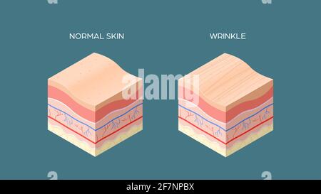 wrinkle and normal skin cross-section of human skin layers structure skincare medical concept flat horizontal Stock Vector