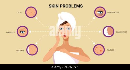 facial skin pimples acne different types on woman face pore comedones cosmetology skincare problems concept flat portrait horizontal Stock Vector