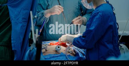 The doctor uses a variety of medical instruments to perform the minimally invasive surgery. Close-up shot of blood-stained hands in sterile gloves and Stock Photo