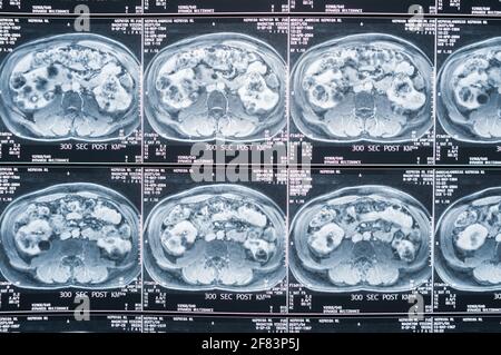 Magnetic resonance imaging, MRI, computed tomography, x-ray