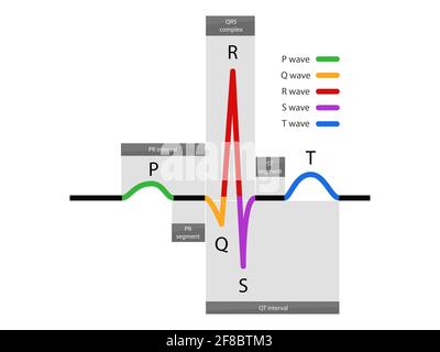 ecg waveform, Normal Atrial And Ventricular Depolarization With Electrocardiogram Description, illustration Stock Photo