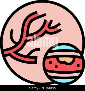 atheroma disease color icon vector illustration Stock Vector