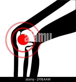 Vector symbol of knee joint bones with paint for orthopedic purposes. Stock Vector