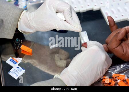 a medical personnel making a rapid test of virus c for a patient , Screening for hepatitis C virus Stock Photo