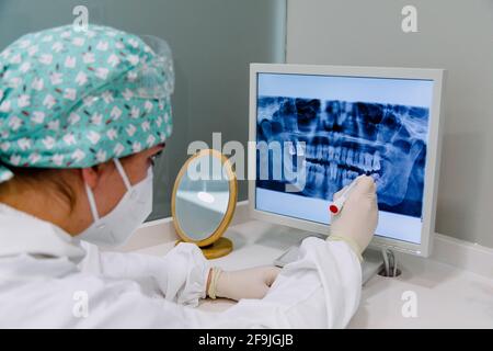Female dentist with an x-ray on the computer pointing out the molars to be extracted Stock Photo