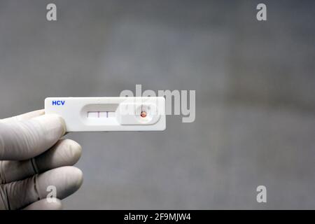 A positive result for Hepatitis C rapid test kit cassette that checks Hepatitis c Virus antibodies held by a medical personnel hand Stock Photo