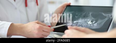 Dentist showing patient tablet with x-ray of teeth in clinic closeup Stock Photo